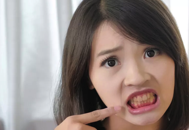 cara memutihkan gigi kuning secara alami